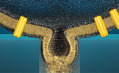 Case Thumbnail Sophion